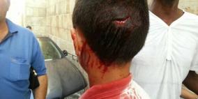 جرحى  مقدسيون في مواجهات  مع المحتلين في الاقصى اليوم 15/9/2015