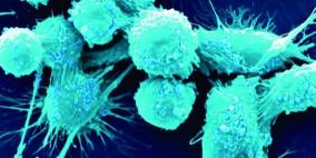 اكتشاف مفتاح رئيسي ينشر الأورام الخبيثة