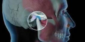 عدم الاهتمام بآلام الأسنان يعرض الطفل إلى تيبس الفك