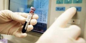 نقص الحديد يسبب الشعور بالتعب والخمول