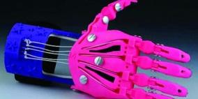 يد آلية "الأولى من نوعها" لطفلة بريطانية