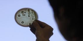 هل سيتقلص متوسط عمر الإنسان إلى 20 سنة مستقبلا؟