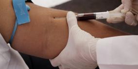 تحاليل حديثة للدم تمهد الطريق للقضاء على الزهايمر