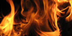 غزة: شاب يقدم على حرق نفسه امام افراد عائلته