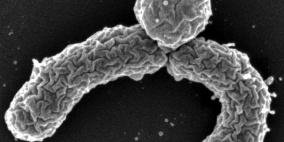 مثبطات تعالج الجمرة الخبيثة