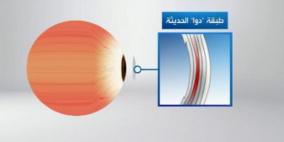 اكتشاف طبقة جديدة في قرنية العين قد يحسن نتائج الجراحات
