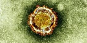 احتمال الشفاء من فيروس كورونا قد يكون ممكناً