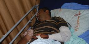 اصابة مواطن اعتدى عليه مستوطنون في قرية قصرة