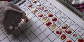 56% فقط من المصريين يعرفون فصيلة دمهم