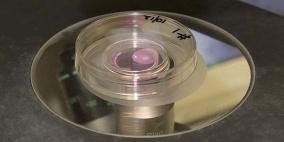 علماء استراليون ينجحون في انتاج كلية من خلايا جذعية