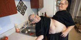 بالصور... أقدم توأم ملتصق فى العالم يحتفل بعيد ميلاده الـ62