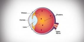 ما هو سر النقاط السابحة التي تظهر أمام العين؟