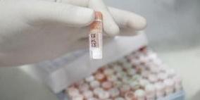 أستاذ ألماني: العلاج بالخلايا الجذعية لا يزال بعيدا عن التطبيق العملي