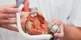 قلب صناعي رابع يمنح الأمل