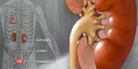 تناول السوائل بالقدر الكافي يجنب الأطفال حصوات الكلى