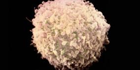 الهندسة الجينية تستطيع قهر الايدز