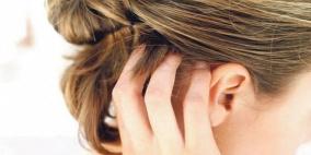 أسباب حكة فروة الرأس وعلاجها!