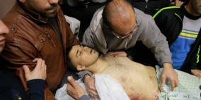 الصور الأولية من المستشفى لشهيد مخيم الجلزون