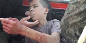 منصور يضع مسؤولين امميين بصورة الجريمة الوحشية بحق الطفل عبد الله عيسى