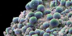 اكتشاف 13 جيناً مسبباً لأعنف أنواع سرطان البروستات