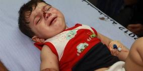 مالطا تتكفل بعلاج أطفال من جرحى العدوان على غزة