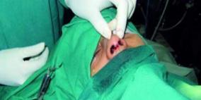 لم ترضه جراحة أنفه.. فهاجم الأطباء وقتل أحدهم