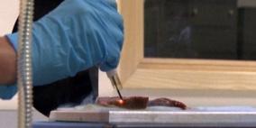 سكين ذكية لاكتشاف الأنسجة السرطانية واستئصالها