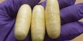 القبض على جراح روسي لسرقته هيروين من معدة مريض