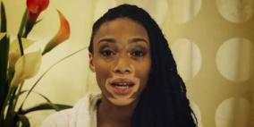 إصابة أمريكية بمرض مايكل جاكسون يغير لون جلدها مثل الحمار الوحشي