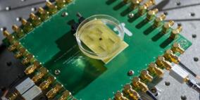 جهاز يصنع صورة ثلاثية الأبعاد للقلب والشرايين