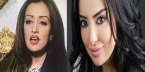 صورة ميساء مغربي قبل عمليات التجميل تغزو مواقع التواصل