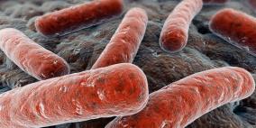 الصحة العالمية: زيادة مقاومة السل للأدوية تهدد مكافحته