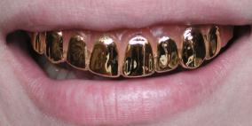 قطرية تدخل "غينيس" بأغلى ابتسامة من الذهب والألماس