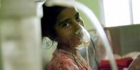 مرض السل يعتبر ثاني أخطر مرض قاتل بعد الإيدز