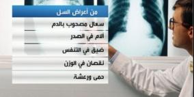 يوم السلّ العالمي.. التهوية والكمامات أبرز سبل الوقاية منه