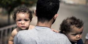 حصيلة اليوم التاسع والاربعين: 17 شهيدا وحوالي 60 جريحا