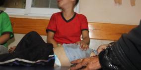 مجزرة الشجاعية... أكثر من 50 شهيدا ونحو 210 جريح