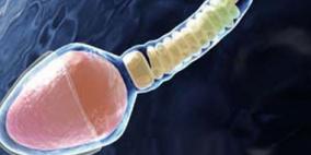 تناول الصودا بكثرة يخفض الحيوانات المنوية للرجال وتزيد وفيات السيدات