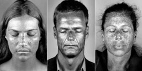 "البرونزاج".. قد يضر بشرتك رغم أنه يبدو جميلاً