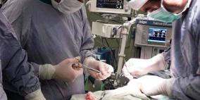غزة: نجاح عملية جراحة نادرة لاستئصال دماغ زائد لرضيعة