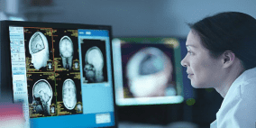 الذكاء الاصطناعي يتفوق على الأطباء في تحليل أشعة القلب 
