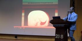  المقاصد ومار يوسف ينظمان المؤتمر الطبي الفلسطيني- الصيني الأول لجراحة المناظير الصدرية