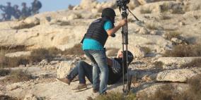 الاحتلال يصيب 3 صحفيين بالرصاص في راس كركر