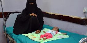  1,500 امرأة حامل يواجهن خطر الموت في مدينة الحديدة لصعوبة الوصول للمستشفيات