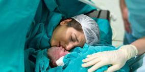إرتفاع عمليات الولادة القيصرية في فلسطين.. الأسباب والمخاطر
