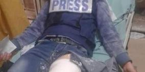 مدى: 19 اعتداء ضد الحريات الاعلامية في فلسطين خلال نيسان