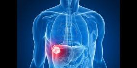 الصحة تؤكد أن لا اصابات بفيروس (B) لمواليد ما بعد 1992