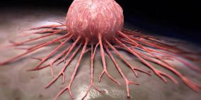 علماء يكتشفون ما يكبح تطور مرض السرطان