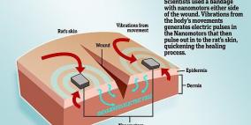 ضمادة إلكترونية.. أمل لجروح لا تلتئم