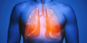 بعد ترك التدخين..الرئة تصلح نفسها وتمنع انتشار الخلايا السرطانية 